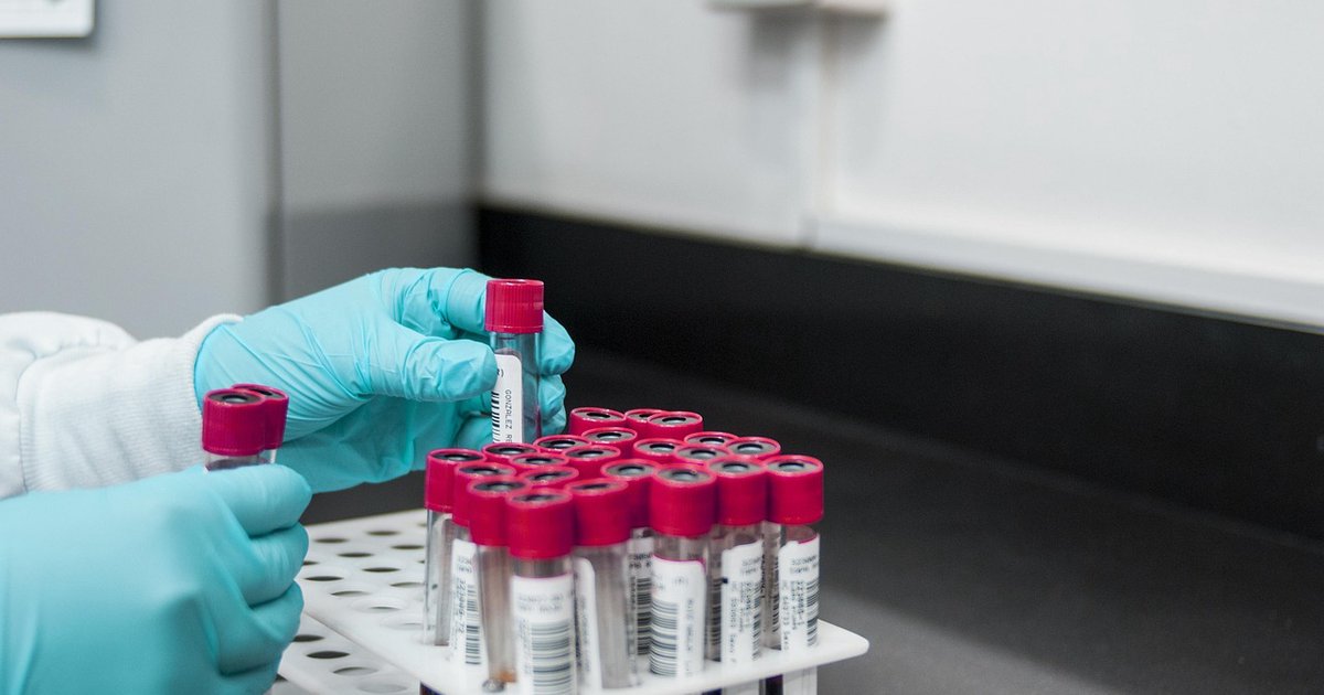 Cholesterol - normy, badania i jak obniżyć podwyższone wartości